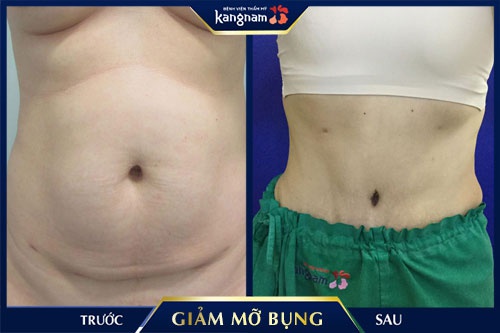 cách giảm béo bụng cho dân văn phòng