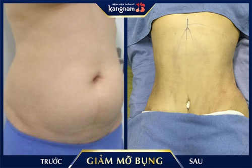 giảm cân hiệu quả cho dân văn phòng 