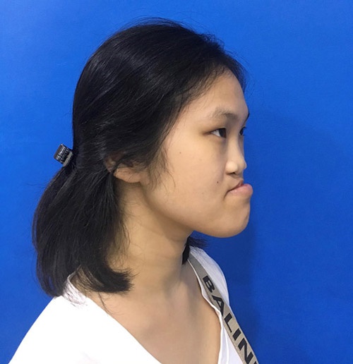 Nguyễn Trang Nhung 