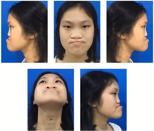 Nguyễn Trang Nhung htlx mùa 4