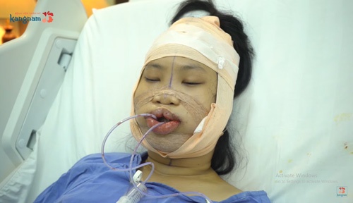 Nguyễn Trang Nhung sau phẫu thuật