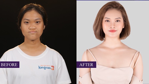 trang nhung lột xác