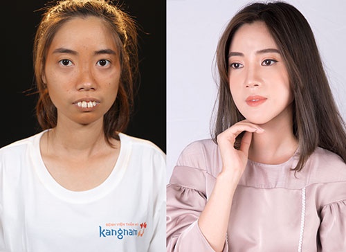 nguyễn thị huê hành trình lột xác tại kangnam nguyễn thị huê hành trình lột xác tại kangnam