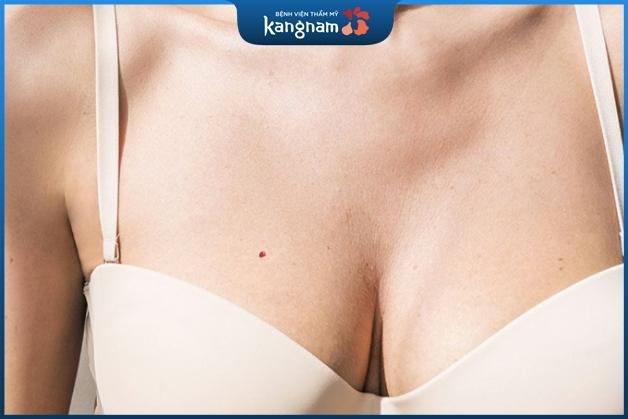 Mụn ruồi son trên ngực là người hạnh phúc