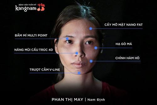 Gương mặt thô cứng của Phan May trước đây đăng ký thay đổi cuộc sống 2018
