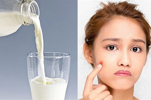 ăn gì để không bị mụn