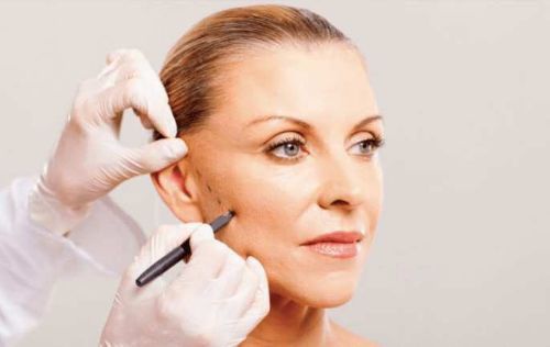 tác hại của căng da mặt