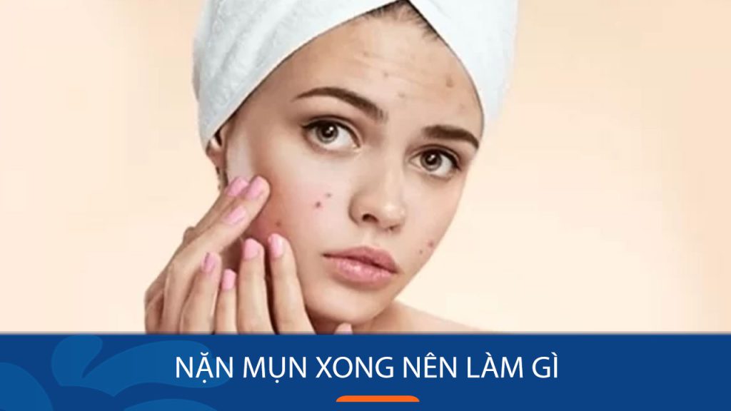 Nặn mụn xong nên làm gì? Bí quyết chăm sóc da sau khi nặn mụn hiệu quả