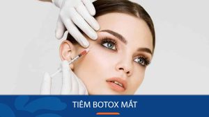 Tiêm botox xóa nhăn vùng mắt: Giữ mãi tuổi xuân chỉ sau 1 lần tiêm