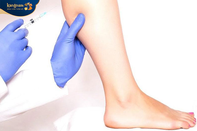 Tiêm thon gọn bắp chân sử dụng Botox
