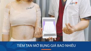 Tiêm tan mỡ bụng là gì? Có Hiệu quả không, Nguy hiểm không