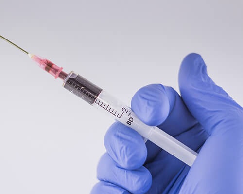 Những tác dụng phụ có thể gặp khi lấy mỡ mắt không phẫu thuật