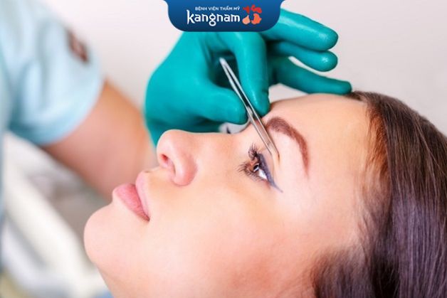 Cắt mí chuẩn tỷ lệ và an toàn tại BV Kangnam