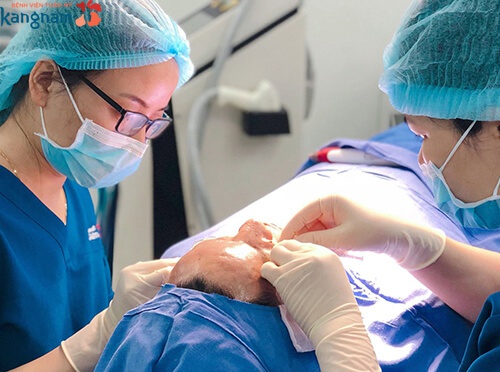 dùng chỉ căng da dùng chỉ căng da