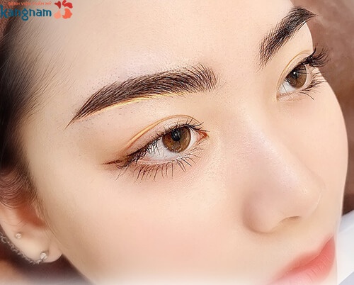 Không để lại sẹo 