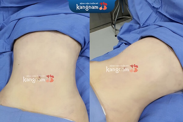 Không phẫu thuật và không xâm lấn