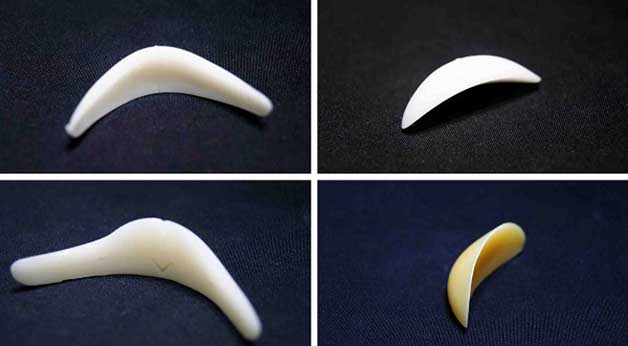 Sụn nhân tạo độn cằm hoàn hảo