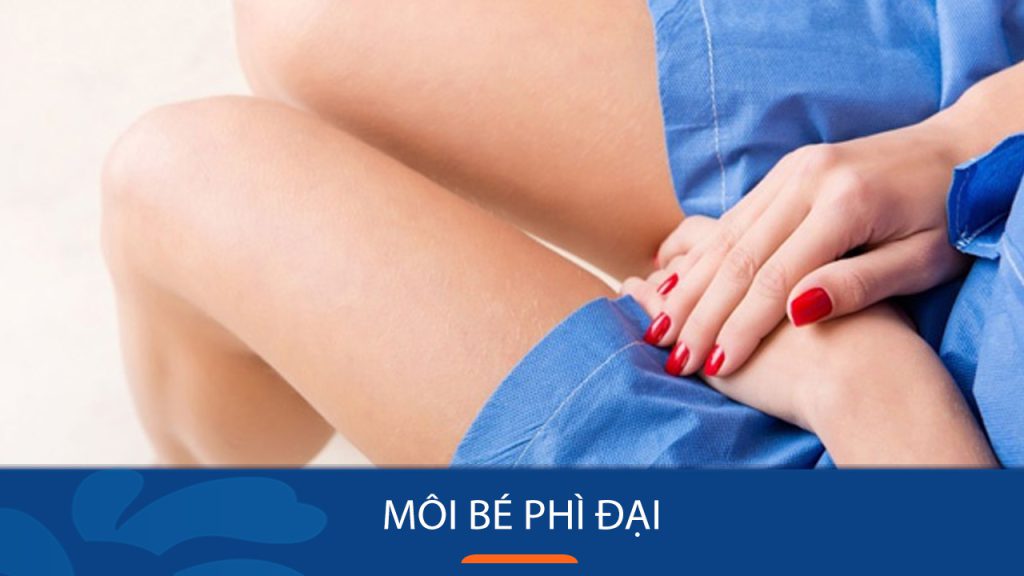 Môi bé phì đại: Nỗi ám ảnh của phụ nữ và giải pháp hoàn hảo