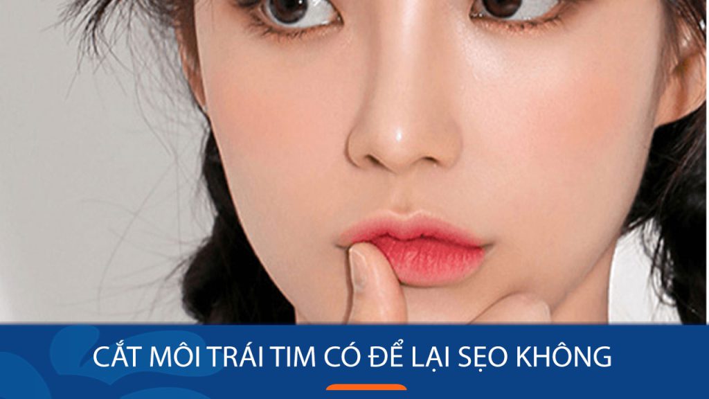Cắt môi trái tim có để lại sẹo không: Bí quyết sở hữu đôi môi trái tim quyến rũ không sẹo