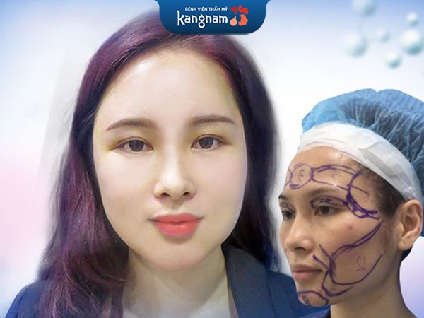 độn thái dương tại kangnam