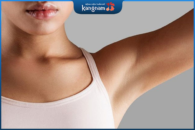 Chị Trần Minh Tr. khuyên mọi người không nên cắt tuyến mồ hôi nách