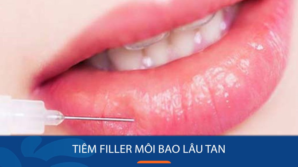 Bảng thời gian tan Filler môi theo từng loại và cách giữ lâu