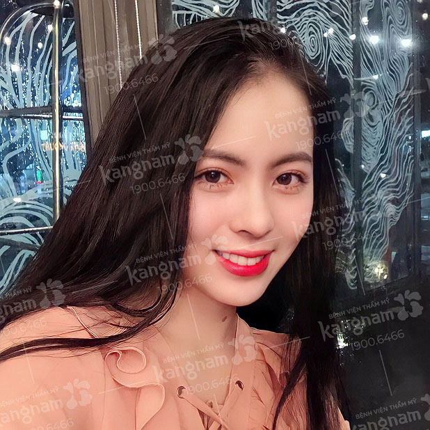 Dáng mũi s line phù hợp với những ai