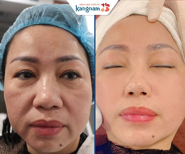 chăm sóc và trẻ hóa da