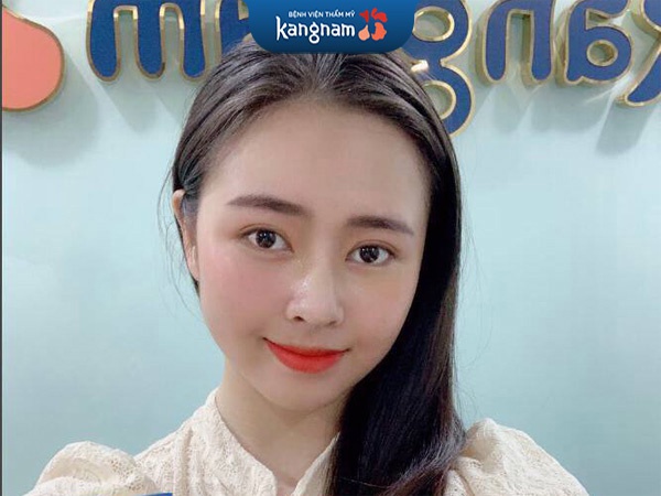 Lợi ích tiêm filler môi không phẫu thuật và không xâm lấn