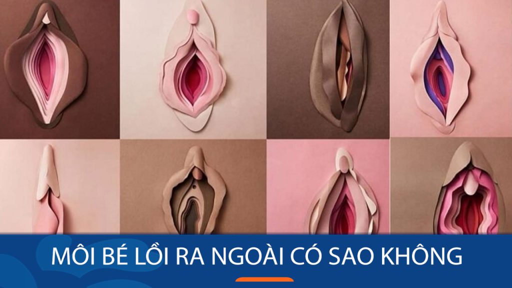 Môi bé lồi ra ngoài: Nguyên nhân, nguy hiểm và cách khắc phục hiệu quả