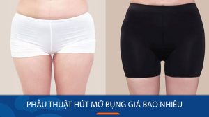 Hút mỡ bụng giá bao nhiêu tiền? Bảng giá mới nhất
