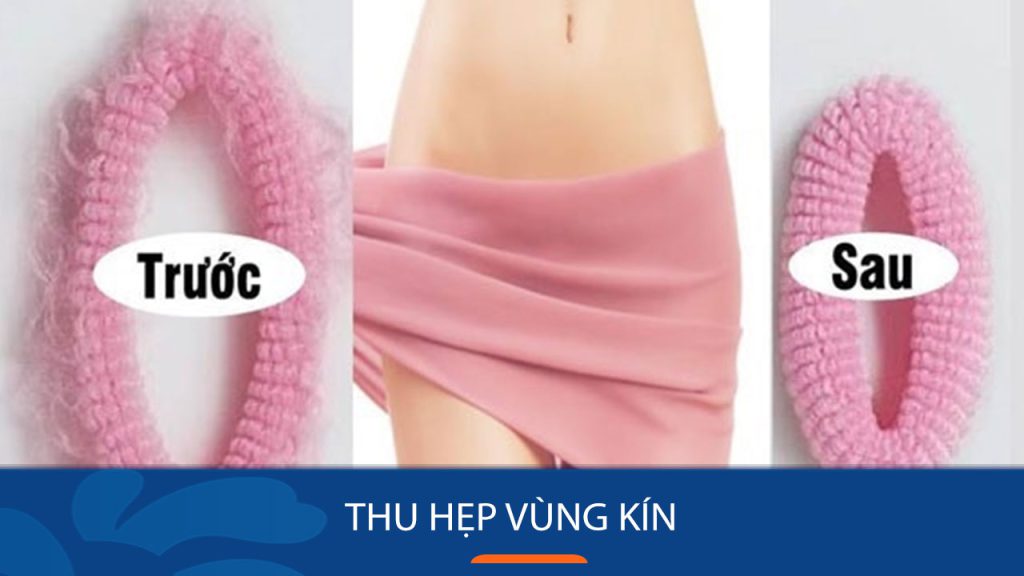 Thu Hẹp Vùng Kín: Lợi ích, Quy trình và Lưu ý quan trọng