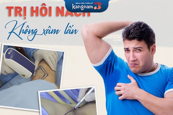 trị hôi nách tại kangnam