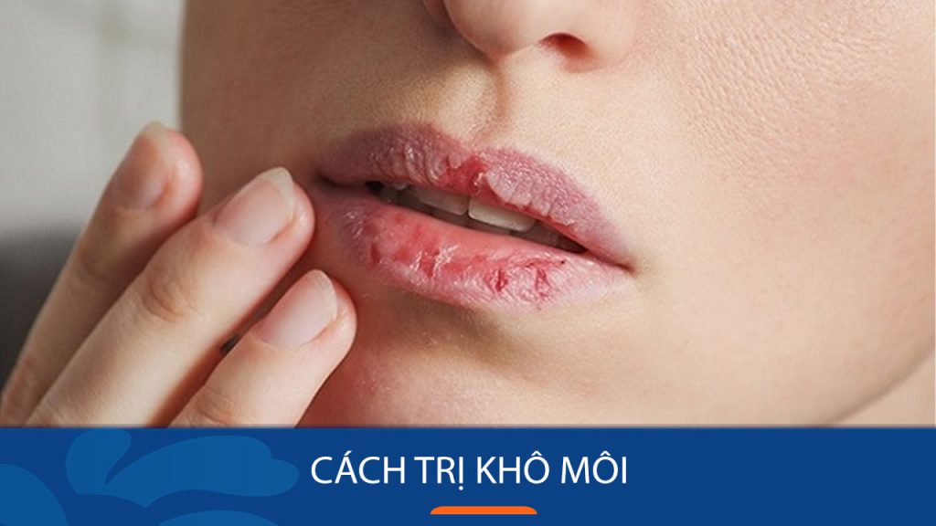 9 Cách trị khô môi nứt nẻ Nhanh, Đơn giản nhất tại nhà