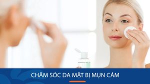 Chăm Sóc Da Mặt Mụn Cám Đúng Cách: Hướng Dẫn Từ A – Z