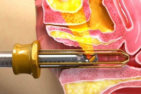 công nghệ thu nhỏ cô bé