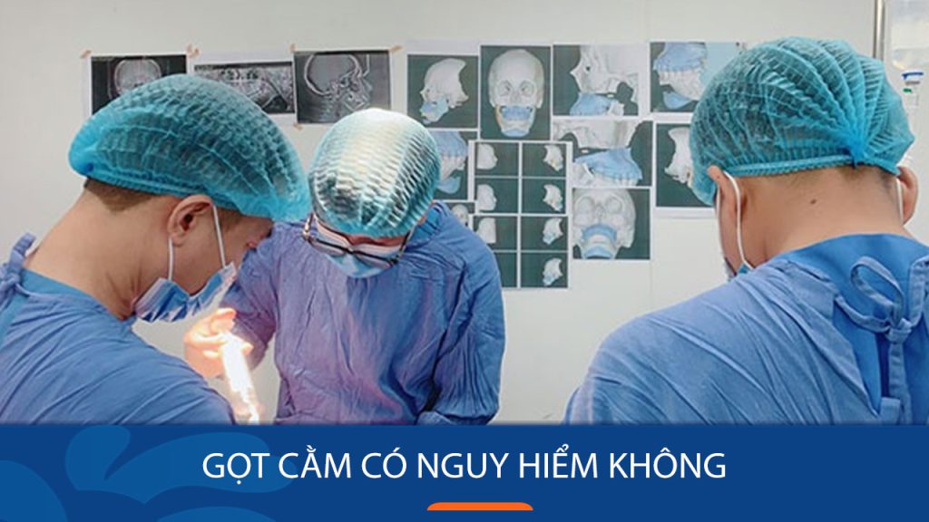 Gọt cằm có nguy hiểm không? Rủi ro có thể gặp và cách giảm thiểu