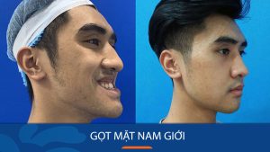 Gọt mặt nam giới: Cách sở hữu khuôn mặt nam tính, thu hút