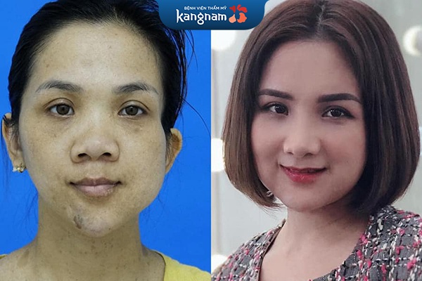 Khách hàng Phan Thị Phúc