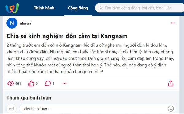 Khách hàng chia sẻ kinh nghiệm độn cằm tại kangnam