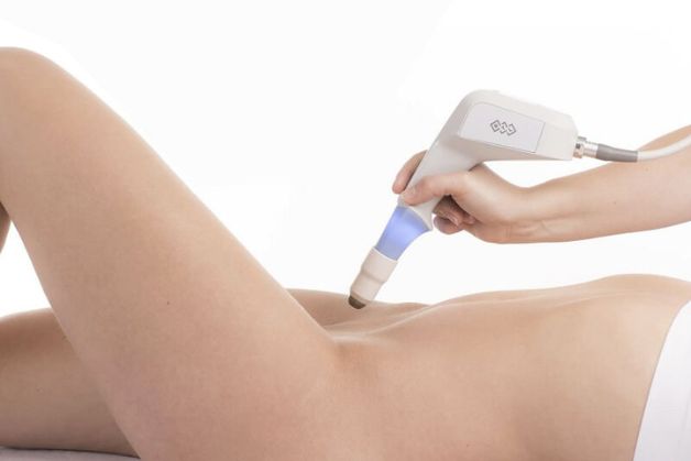 Làm vùng kín hết thâm bằng laser