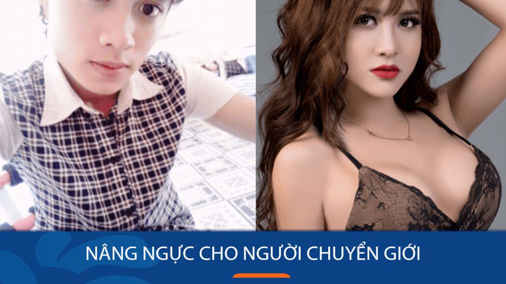 Nâng ngực cho người chuyển giới: Bí quyết sở hữu vòng 1 hoàn hảo