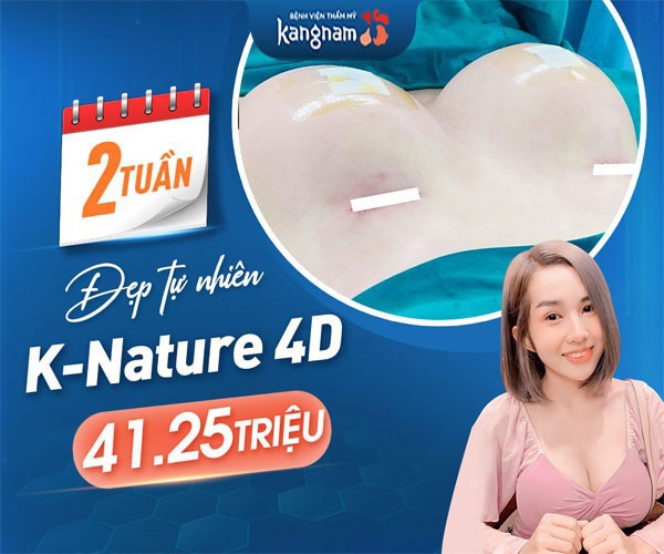 nâng ngực k nature 4d