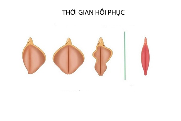 thời gian hồi phục