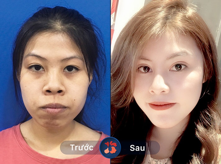 ALBUM KHÁCH HÀNG THẨM MỸ HÀM MẶT