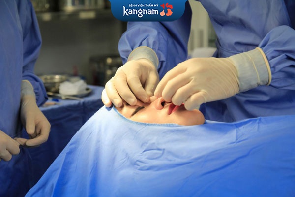 bác sĩ thực hiện nâng mũi