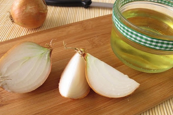 chữa sẹo với hành tây và dầu oliu