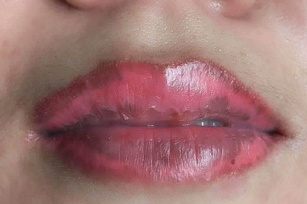 Phụ thuộc vào cơ địa khách hàng