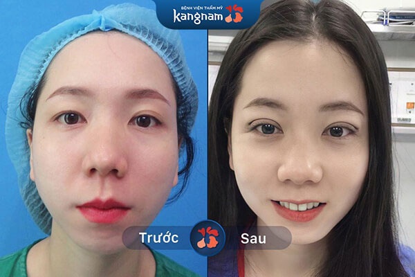 dịch vụ kangnam có tốt không