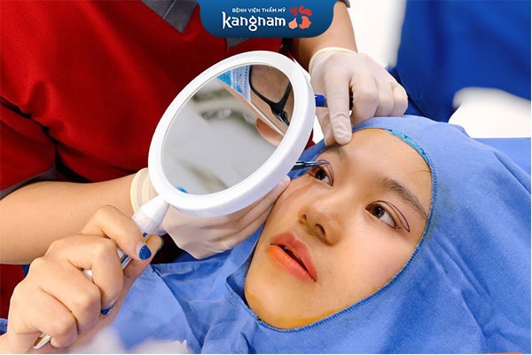 dịch vụ thẩm mỹ mắt